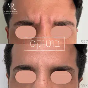 ד"ר משה רוזן רפואה אסתטית